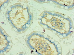 Immunohistochemistry of paraffin-embedded human small intestine tissue using CSB-PA024153ESR2HU at dilution of 1:100