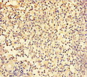 Immunohistochemistry of paraffin-embedded human spleen tissue using CSB-PA024153LA01HU at dilution of 1:100