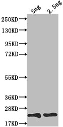 Western Blot Positive WB detected in Recombinant protein All lanes: TRBC2 antibody at 1:2000 Secondary Goat polyclonal to rabbit IgG at 1/50000 dilution Predicted band size: 19.7 kDa Observed band size: 20 kDa