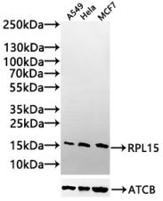 Western Blot Positive WB detected in: A549 whole cell lysate(30µg), Hela whole cell lysate30µg), MCF7 whole cell lysate(30µg) All lanes: RPL15 antibody at 1:1000 Secondary Goat polyclonal to rabbit IgG at 1/20000 dilution Predicted band size: 25,...