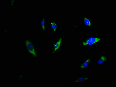 Immunofluorescence staining of U251 cells with CSB-PA024398LA01HU at 1:66, counter-stained with DAPI. The cells were fixed in 4% formaldehyde, permeabilized using 0.2% Triton X-100 and blocked in 10% normal Goat Serum. The cells were then incubate...