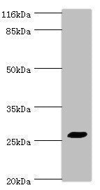 Western blot All lanes: TREM1 antibody at 2ug/ml + HepG2 whole cell lysate Secondary Goat polyclonal to rabbit IgG at 1/10000 dilution Predicted band size: 27, 18, 26 kDa Observed band size: 27 kDa
