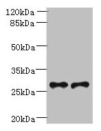 Western blot All lanes: Trem2 antibody at 6µg/ml Lane 1: Mouse liver tissue Lane 2: THP-1 whole cell lysate Secondary Goat polyclonal to rabbit IgG at 1/10000 dilution Predicted band size: 25, 28 kDa Observed band size: 28 kDa