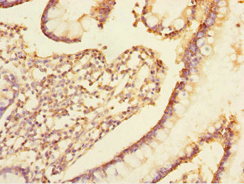 Immunohistochemistry of paraffin-embedded human small intestine tissue using CSB-PA024443ESR2HU at dilution of 1:100