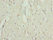 Immunohistochemistry of paraffin-embedded human brain tissue using CSB-PA024450ESR1HU at dilution of 1:100
