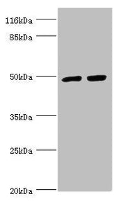 Western blot All lanes: TRIM13 antibody at 1.44µg/ml Lane 1: 293T whole cell lysate Lane 2: Hela whole cell lysate Secondary Goat polyclonal to rabbit IgG at 1/10000 dilution Predicted band size: 47, 20, 48 kDa Observed band size: 47 kDa