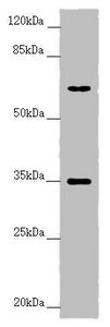 Western blot All lanes: TRIM23 antibody at 4.55 ug/ml + Raw264.7 whole cell lysate Secondary Goat polyclonal to rabbit IgG at 1/10000 dilution Predicted band size: 65, 64, 62 kDa Observed band size: 65, 35 kDa