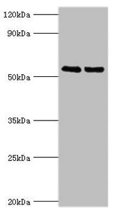 Western blot All lanes: TRIM27 antibody at 4µg/ml Lane 1: Jurkat whole cell lysate Lane 2: HepG2 whole cell lysate Secondary Goat polyclonal to rabbit IgG at 1/10000 dilution Predicted band size: 59, 42 kDa Observed band size: 59 kDa