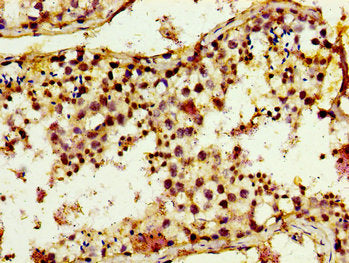 Immunohistochemistry of paraffin-embedded human testis tissue using CSB-PA024467LA01HU at dilution of 1:100