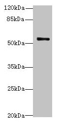 Western blot All lanes: TRIM38 antibody at 4µg/ml + Jurkat whole cell lysate Secondary Goat polyclonal to rabbit IgG at 1/10000 dilution Predicted band size: 54 kDa Observed band size: 54 kDa