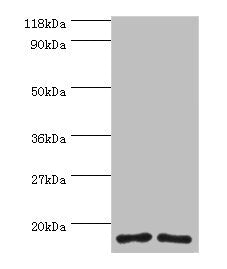 Western blot All lanes: RPS16 protein antibody at 2µg/ml Lane 1: 293T whole cell lysate Lane 2: EC109 whole cell lysate Secondary Goat polyclonal to rabbit IgG at 1/15000 dilution Predicted band size: 17 kDa Observed band size: 17 kDa