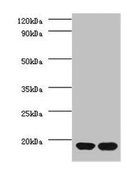 Western blot All lanes: RPS13 antibody at 2µg/ml Lane 1: EC109 whole cell lysate Lane 2: 293T whole cell lysate Secondary Goat polyclonal to rabbit IgG at 1/15000 dilution Predicted band size: 18 kDa Observed band size: 18 kDa