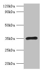 Western blot All lanes: RPL5 antibody at 2µg/ml + EC109 whole cell lysate Secondary Goat polyclonal to rabbit IgG at 1/15000 dilution Predicted band size: 35 kDa Observed band size: 35 kDa