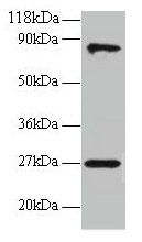 Western blot All lanes: RPL17 antibody at 2µg/ml + EC109 whole cell lysate Secondary Goat polyclonal to rabbit IgG at 1/15000 dilution Predicted band size: 22, 18, 27 kDa Observed band size: 27, 80 kDa