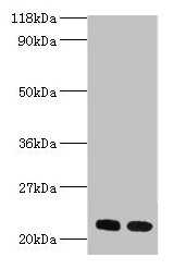 Western blot All lanes: RPL17 antibody at 2µg/ml Lane 1: EC109 whole cell lysate Lane 2: 293T whole cell lysate Secondary Goat polyclonal to rabbit IgG at 1/15000 dilution Predicted band size: 22, 18, 27 kDa Observed band size: 22 kDa