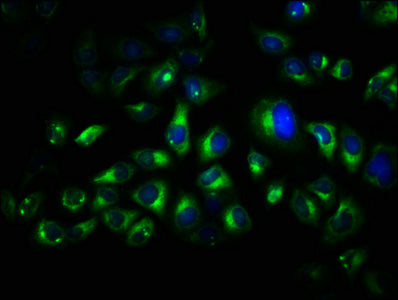 Immunofluorescence staining of Hela cells with CSB-PA025069LA01HU at 1:66, counter-stained with DAPI. The cells were fixed in 4% formaldehyde, permeabilized using 0.2% Triton X-100 and blocked in 10% normal Goat Serum. The cells were then incubate...
