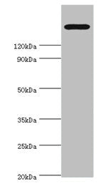 Western blot All lanes: TRPM2 antibody at 2µg/ml + K562 whole cell lysate Secondary Goat polyclonal to rabbit IgG at 1/10000 dilution Predicted band size: 172, 166, 96 kDa Observed band size: 172 kDa