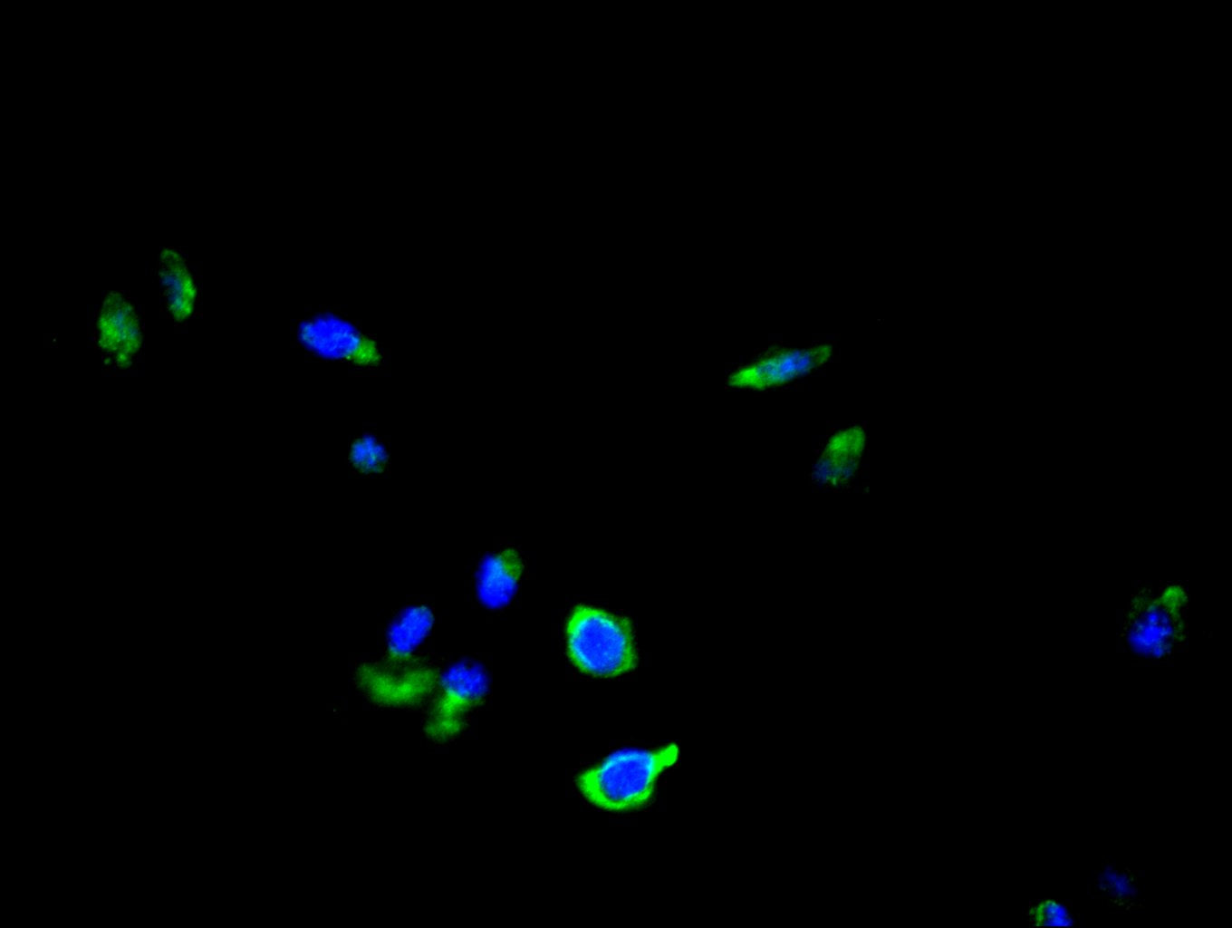 Immunofluorescence staining of A549 cell with CSB-PA025152LA01HU at 1:30, counter-stained with DAPI. The cells were fixed in 4% formaldehyde and blocked in 10% normal Goat Serum. The cells were then incubated with the antibody overnight at 4C. The...