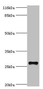 Western blot All lanes: TSPAN6 antibody at 20µg/ml + Mouse liver tissue Secondary Goat polyclonal to rabbit IgG at 1/10000 dilution Predicted band size: 28 kDa Observed band size: 28 kDa
