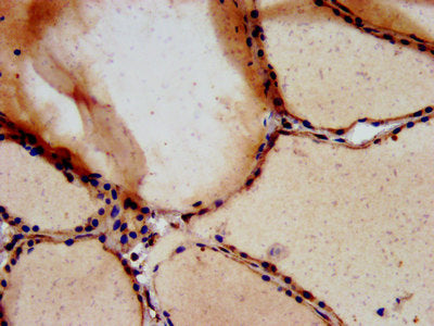 IHC image of CSB-PA025167LA01HU diluted at 1:700 and staining in paraffin-embedded human thyroid tissue performed on a Leica BondTM system. After dewaxing and hydration, antigen retrieval was mediated by high pressure in a citrate buffer (pH 6.0)....