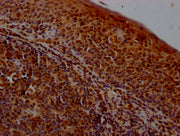 IHC image of CSB-PA02519A0Rb diluted at 1:400 and staining in paraffin-embedded human tonsil tissue performed on a Leica BondTM system. After dewaxing and hydration, antigen retrieval was mediated by high pressure in a citrate buffer (pH 6.0). Sec...