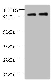 Western blot All lanes: RPS12 antibody at 2µg/ml Lane 1: EC109 whole cell lysate Lane 2: 293T whole cell lysate Secondary Goat polyclonal to rabbit IgG at 1/15000 dilution Predicted band size: 15 kDa Observed band size: 90 kDa