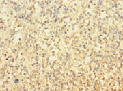 Immunohistochemistry of paraffin-embedded human spleen tissue using CSB-PA025315LA01HU at dilution of 1:100