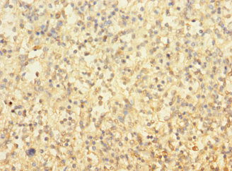 Immunohistochemistry of paraffin-embedded human spleen tissue using CSB-PA025315LA01HU at dilution of 1:100
