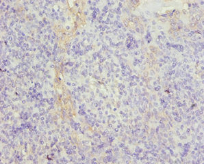 Immunohistochemistry of paraffin-embedded human tonsil tissue using CSB-PA025318NJ01HU at dilution of 1:100