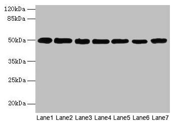 Western blot All lanes: TUBB antibody at 6µg/ml Lane 1: PC-3 whole cell lysate Lane 2: 293T whole cell lysate Lane 3: A549 whole cell lysate Lane 4: HepG2 whole cell lysate Lane 5: SH-SY5Y whole cell lysate Lane 6: Hela whole cell lysate Lane 7: Z...