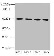 Western blot All lanes: TUBB2A antibody at 14µg/ml Lane 1: MCF-7 whole cell lysate Lane 2: Hela whole cell lysate Lane 3: HepG2 whole cell lysate Lane 4: MDA-MB-231 whole cell lysate Secondary Goat polyclonal to rabbit IgG at 1/10000 dilution Pred...