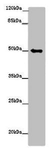 Western blot All lanes: TUBG1 antibody at 14ug/ml + Hela whole cell lysate Secondary Goat polyclonal to rabbit IgG at 1/10000 dilution Predicted band size: 52 kDa Observed band size: 52 kDa