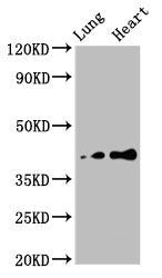 Western Blot Positive WB detected in: Rat lung tissue, Rat heart tissue All lanes: TUSC3 antibody at 4.7ug/ml Secondary Goat polyclonal to rabbit IgG at 1/50000 dilution Predicted band size: 40 kDa Observed band size: 40 kDa