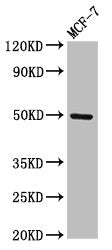 Western Blot Positive WB detected in: MCF-7 whole cell lysate All lanes: TWIST1 antibody at 3µg/ml Secondary Goat polyclonal to rabbit IgG at 1/50000 dilution Predicted band size: 21 kDa Observed band size: 50 kDa