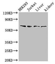 Western Blot Positive WB detected in: HEK293 whole cell lysate, Jurkat whole cell lysate, Rat liver tissue, Rat kidney tissue All lanes: TXK antibody at 3µg/ml Secondary Goat polyclonal to rabbit IgG at 1/50000 dilution Predicted band size: 62 kDa...