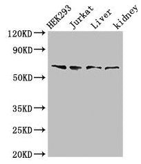 Western Blot Positive WB detected in: HEK293 whole cell lysate, Jurkat whole cell lysate, Rat liver tissue, Rat kidney tissue All lanes: TXK antibody at 3µg/ml Secondary Goat polyclonal to rabbit IgG at 1/50000 dilution Predicted band size: 62 kDa...