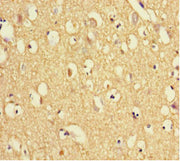 Immunohistochemistry of paraffin-embedded human brain tissue using CSB-PA025382LA01HU at dilution of 1:100