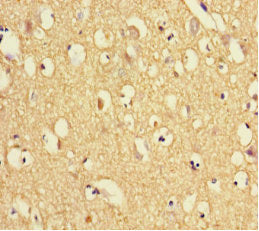 Immunohistochemistry of paraffin-embedded human brain tissue using CSB-PA025382LA01HU at dilution of 1:100