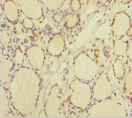 Immunohistochemistry of paraffin-embedded human thyroid tissue using CSB-PA025384HA01HU at dilution of 1:100