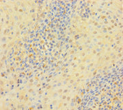 Immunohistochemistry of paraffin-embedded human tonsil tissue using CSB-PA025392LA01HU at dilution of 1:100