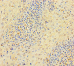 Immunohistochemistry of paraffin-embedded human tonsil tissue using CSB-PA025392LA01HU at dilution of 1:100