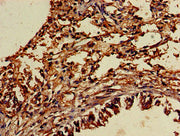 Immunohistochemistry of paraffin-embedded human lung tissue using CSB-PA025396LA01HU at dilution of 1:100