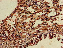 Immunohistochemistry of paraffin-embedded human lung tissue using CSB-PA025396LA01HU at dilution of 1:100