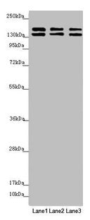 Western blot All lanes: UACA antibody at 5.51µg/ml Lane 1: Hela whole cell lysate Lane 2: A549 whole cell lysate Lane 3: Jurkat whole cell lysate Secondary Goat polyclonal to rabbit IgG at 1/10000 dilution Predicted band size: 163, 162 kDa Observe...