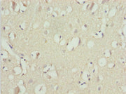 Immunohistochemistry of paraffin-embedded human brain tissue using CSB-PA025420ESR1HU at dilution of 1:100