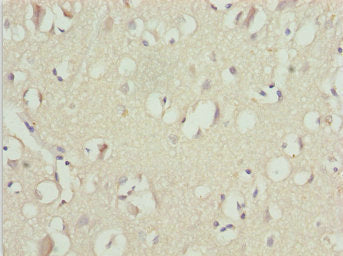 Immunohistochemistry of paraffin-embedded human brain tissue using CSB-PA025420ESR1HU at dilution of 1:100