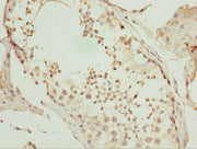 Immunohistochemistry of paraffin-embedded human testis tissue using CSB-PA025420ESR2HU at dilution of 1:100