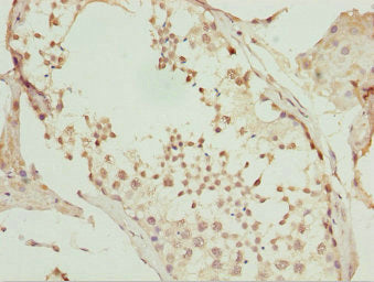 Immunohistochemistry of paraffin-embedded human testis tissue using CSB-PA025420ESR2HU at dilution of 1:100