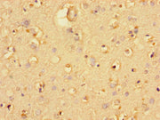 Immunohistochemistry of paraffin-embedded human brain tissue using CSB-PA025420LA01HU at dilution of 1:100