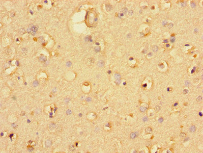 Immunohistochemistry of paraffin-embedded human brain tissue using CSB-PA025420LA01HU at dilution of 1:100